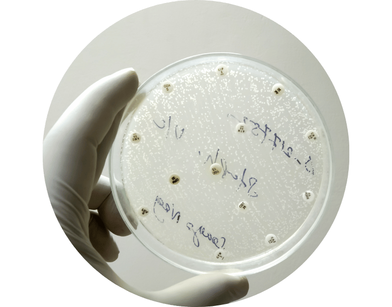 candida belirtileri