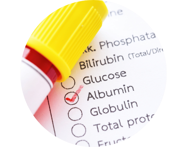 albumin düşüklüğü