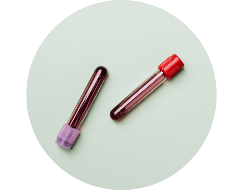 bakteremi kan zehirlenmesi