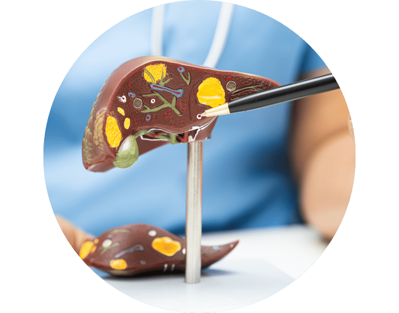 karaciğer yağlanması belirtileri